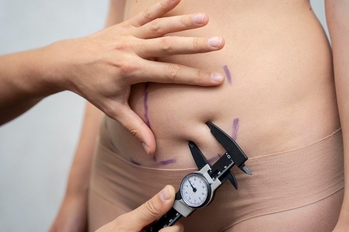 Experience Advanced Body Contouring with Vaser Liposuction: Key Benefits and Features