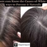 Wellhealthorganic.comKnow-the-Causes-of-White-hair-and-Easy-ways-to-Prevent-it-Naturally