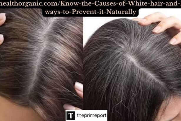 Wellhealthorganic.comKnow-the-Causes-of-White-hair-and-Easy-ways-to-Prevent-it-Naturally