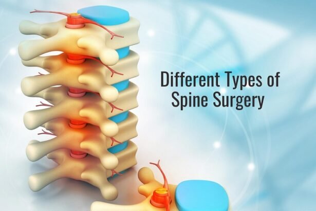 2 Types of Disc Surgery